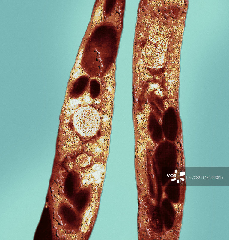 炭疽杆菌，透射电镜图片素材