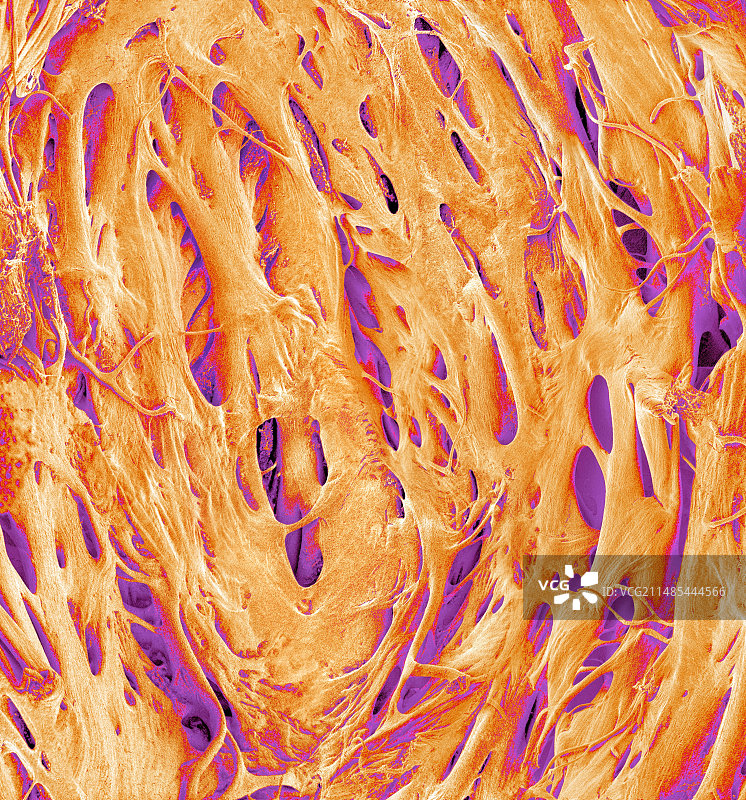 心脏肉柱，扫描电子显微镜图片素材