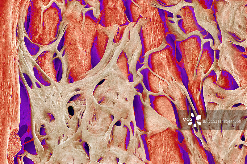 心脏肉柱，扫描电子显微镜图片素材