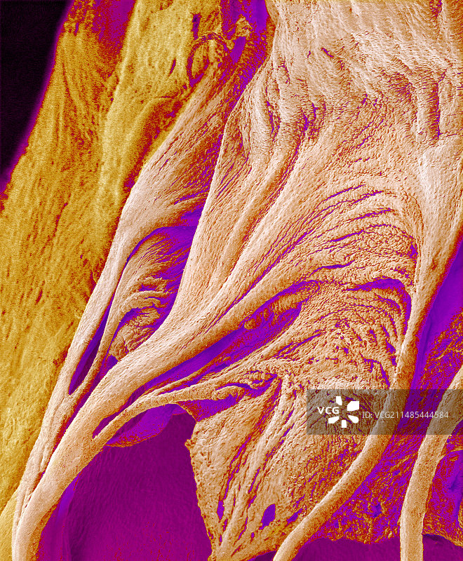 心脏瓣膜和腱索，扫描电子显微镜图图片素材