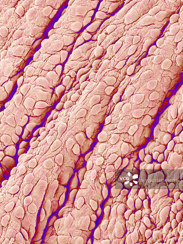 心脏瓣膜表面扫描电镜图图片素材