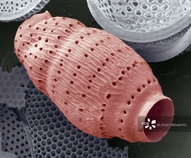 放射虫扫描电镜图片素材