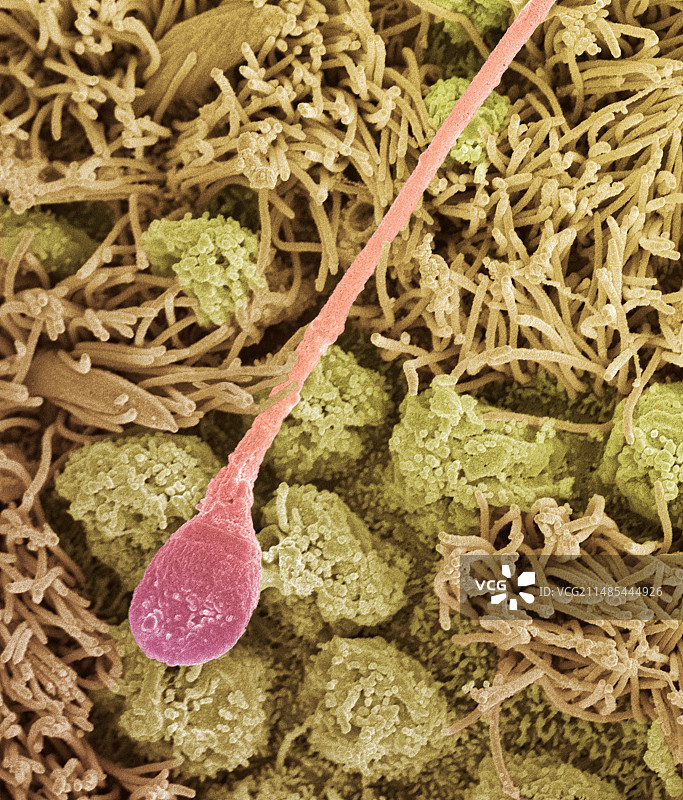 精子细胞扫描电镜图图片素材