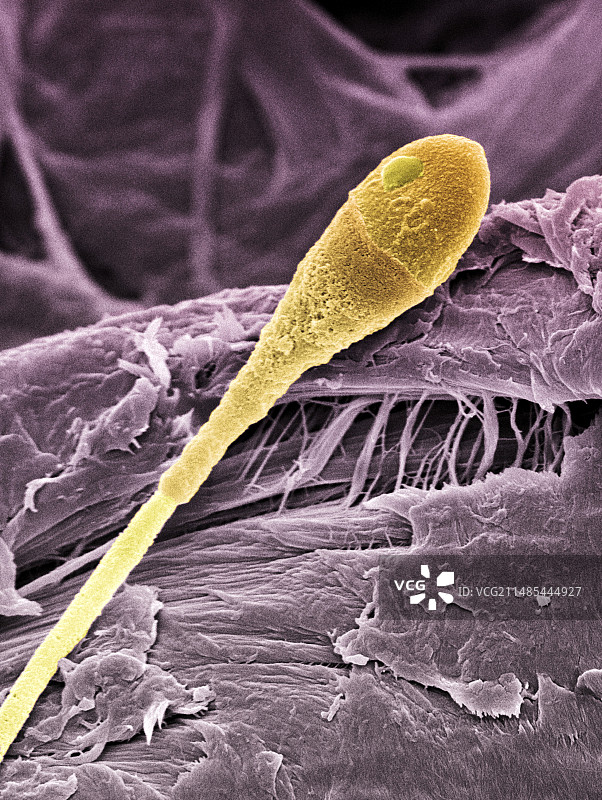 精子细胞扫描电镜图图片素材