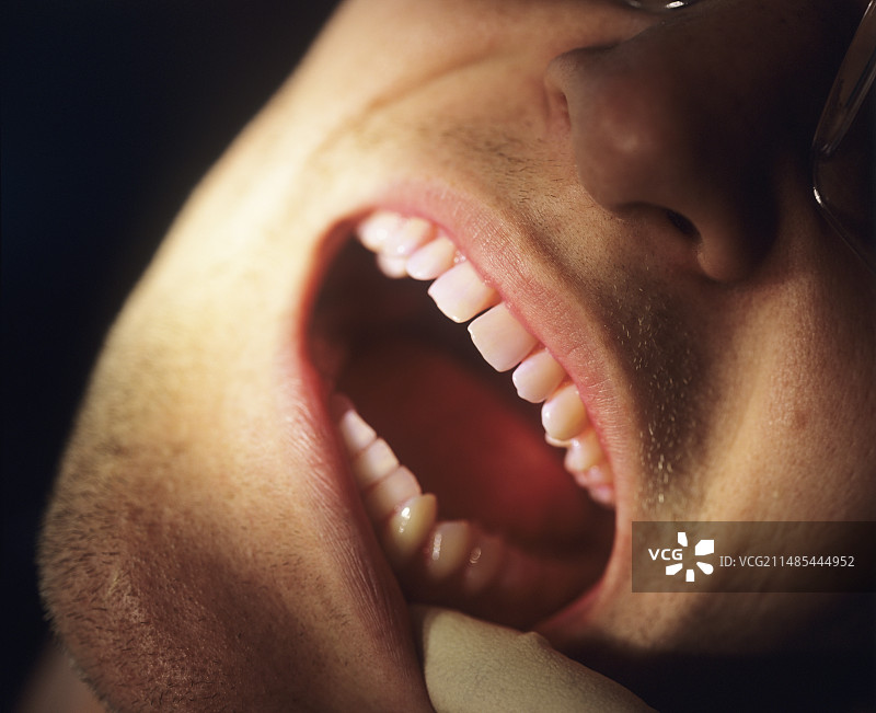 斑块检测图片素材