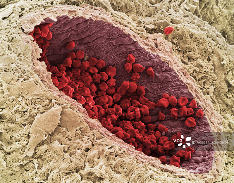 红细胞扫描电子显微镜图像图片素材