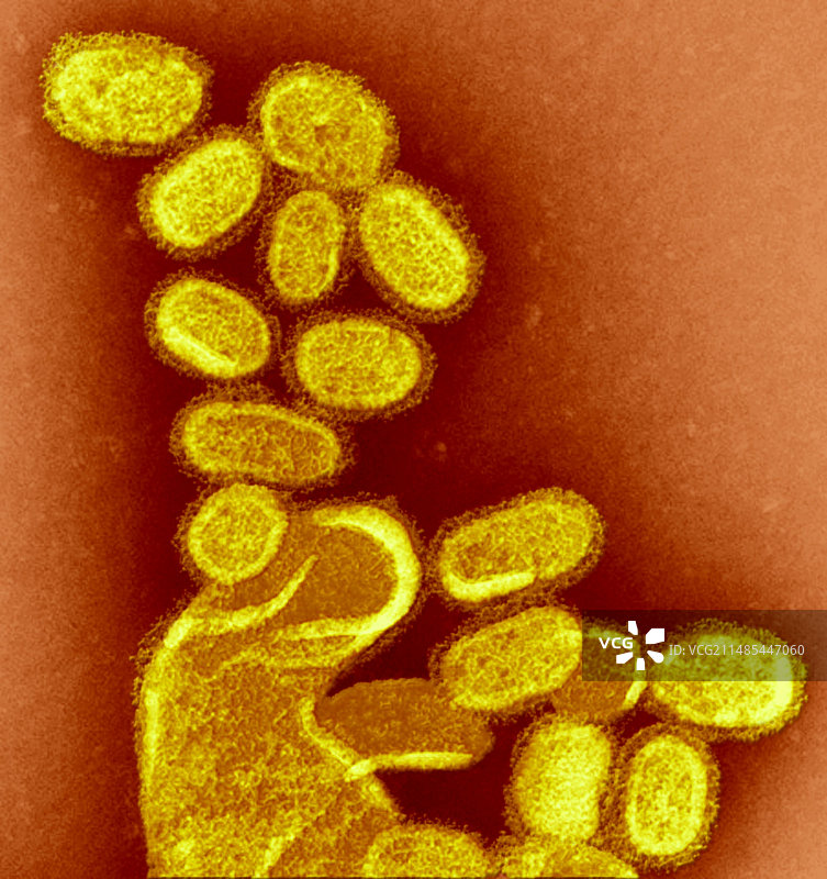 1918年H1N1流感病毒TEM图图片素材