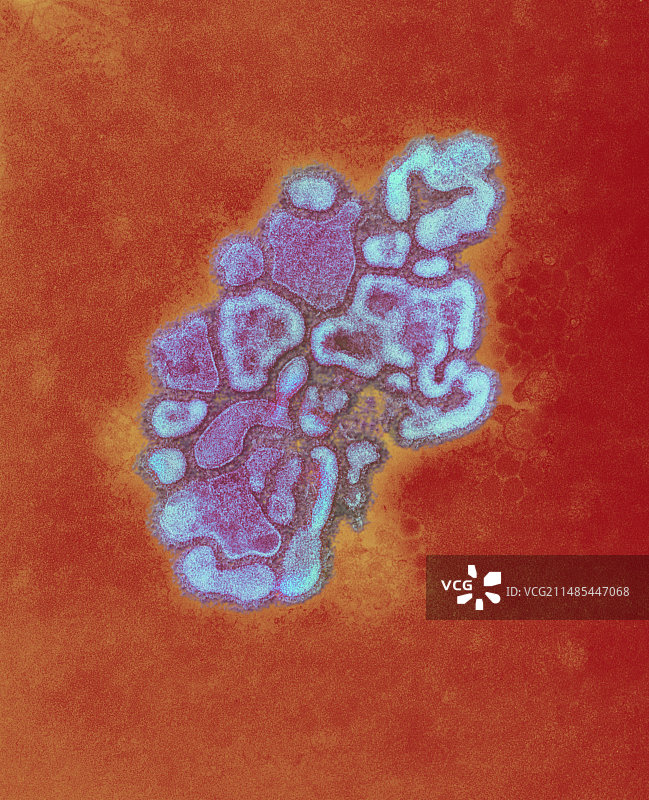 H1N1 1976年猪流感病毒TEM图片素材