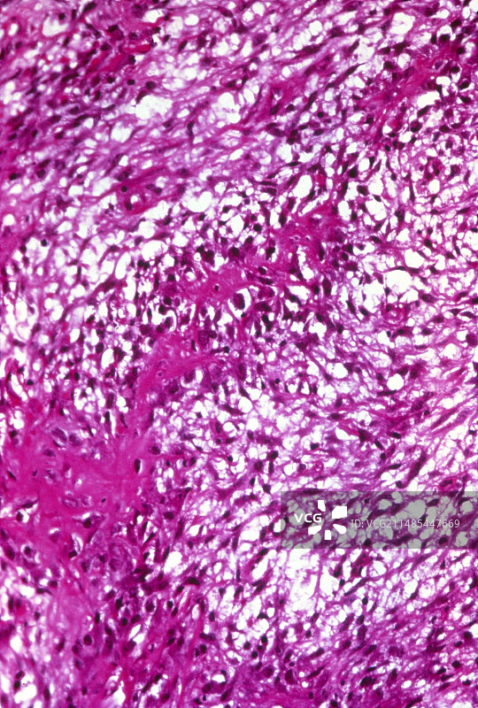 骨修复显微照片图片素材