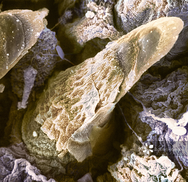 舌乳头扫描电镜图图片素材