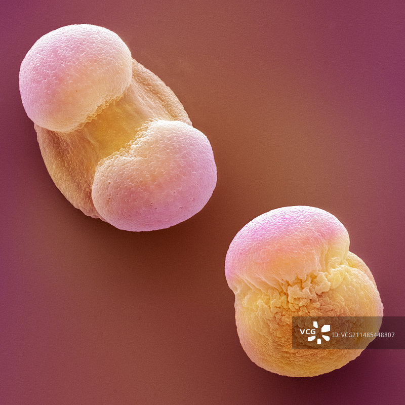 苏格兰松树花粉扫描电镜图图片素材