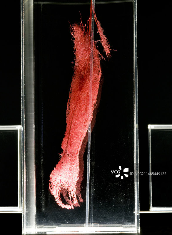 塑化手臂血管展示图片素材