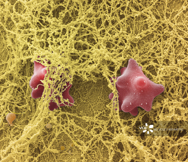 血栓扫描电镜图片素材