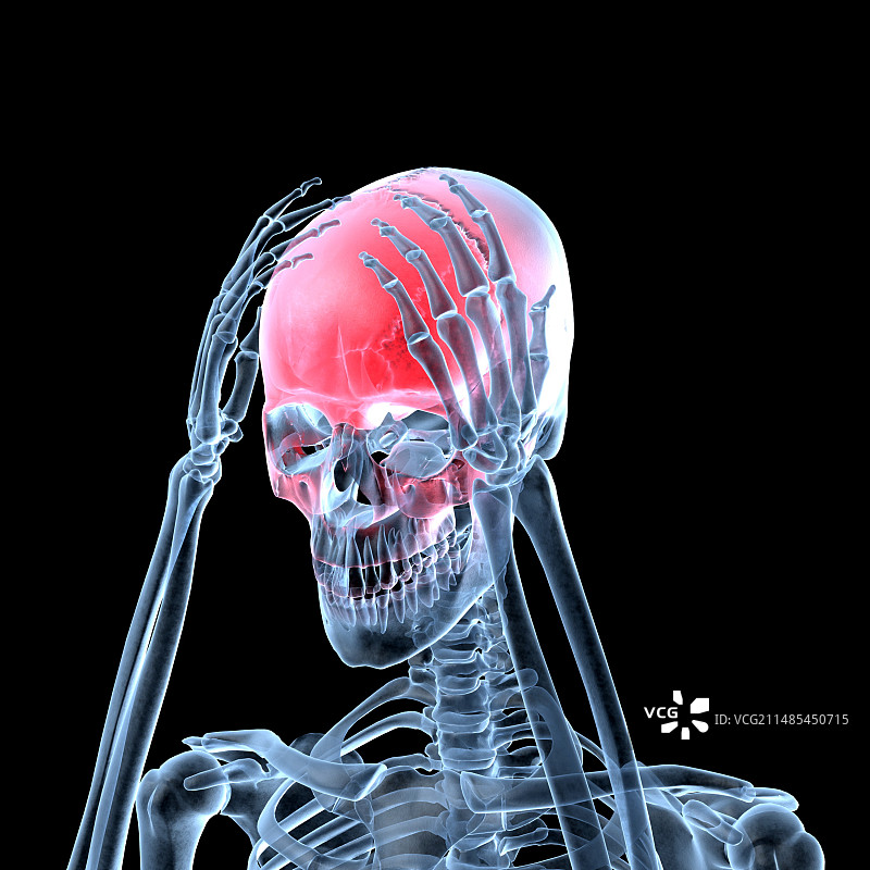 头疼。图片素材