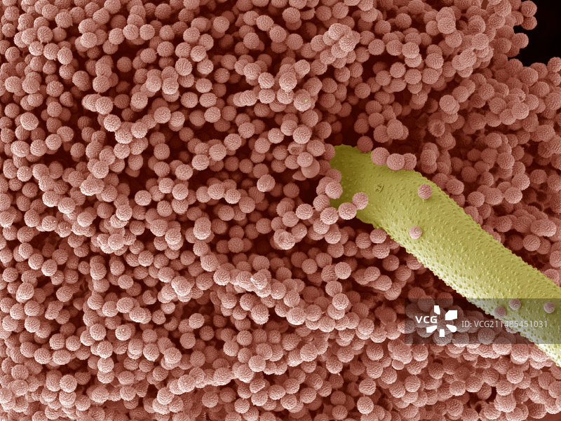 曲霉菌孢子扫描电镜图图片素材