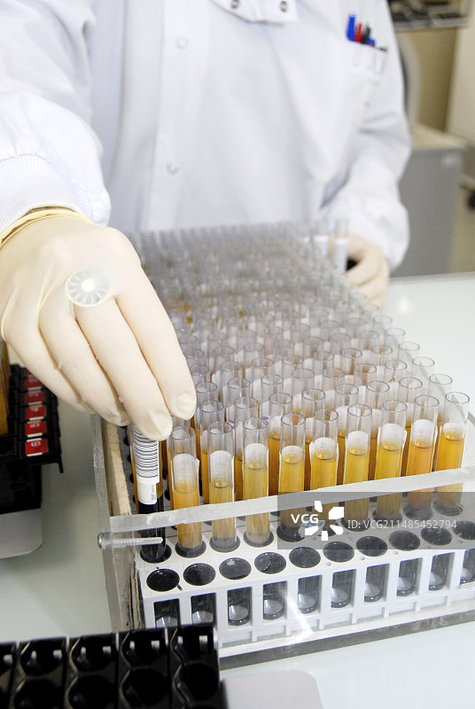 血液分析图片素材