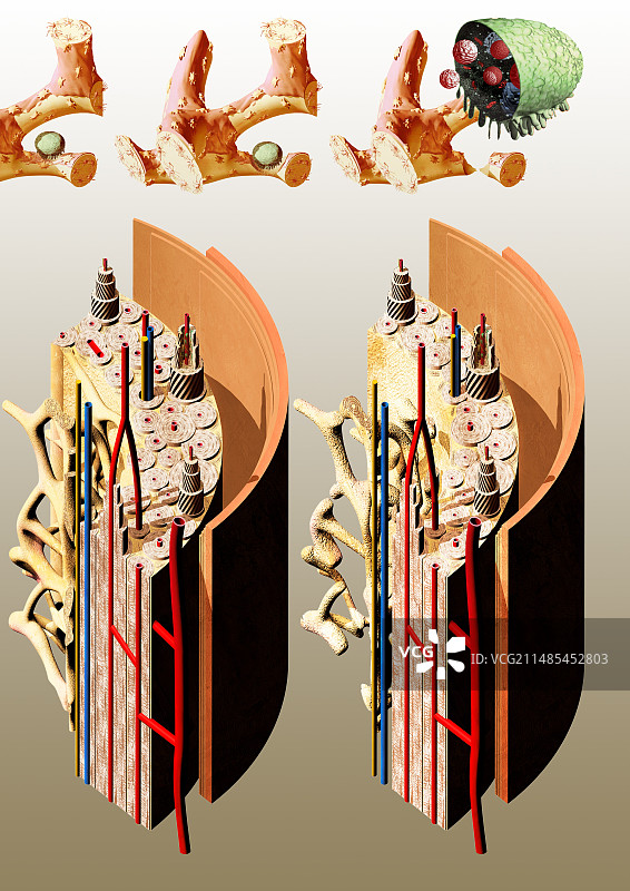 骨质疏松症图片素材