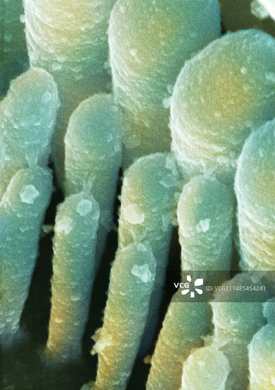 内耳毛细胞扫描电镜图图片素材