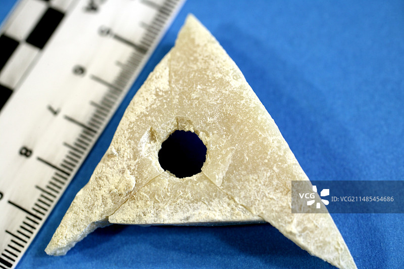 头骨枪伤分析图片素材