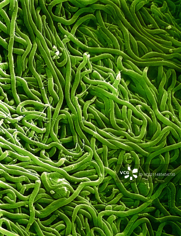 疏螺旋体细菌扫描电镜图片素材