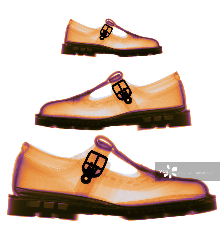 儿童鞋X光片图片素材