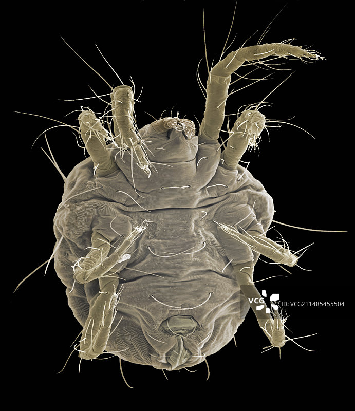 螨虫，扫描电镜图片素材