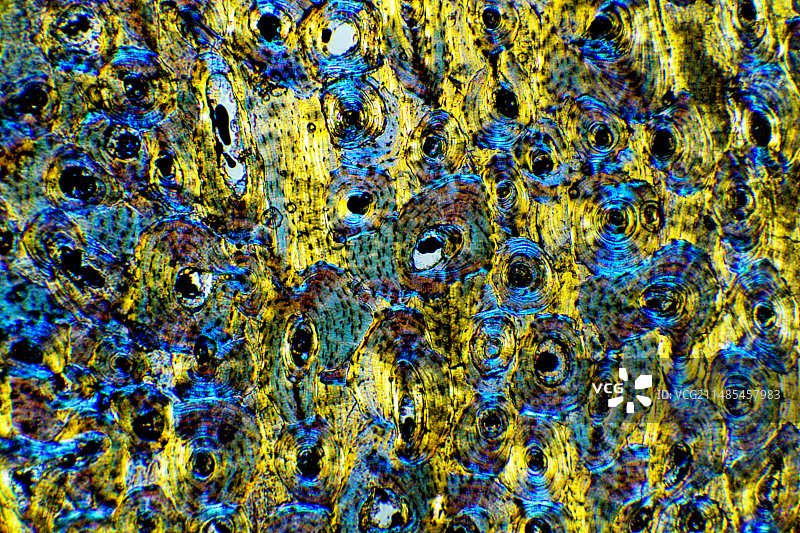 骨骼结构显微照片图片素材