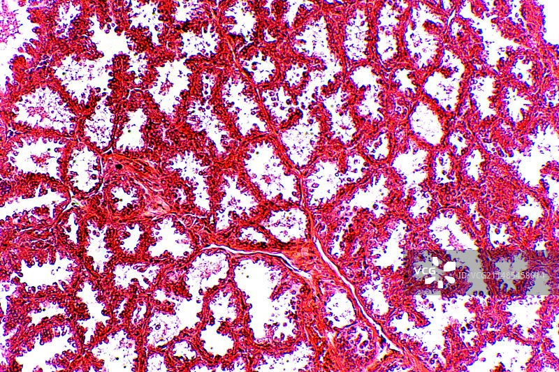 乳腺组织光学显微照片图片素材
