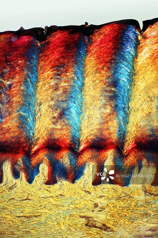 脚后跟皮肤组织显微照片图片素材