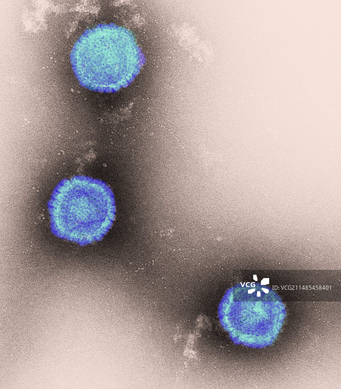 疱疹病毒颗粒（透射电子显微镜）图片素材