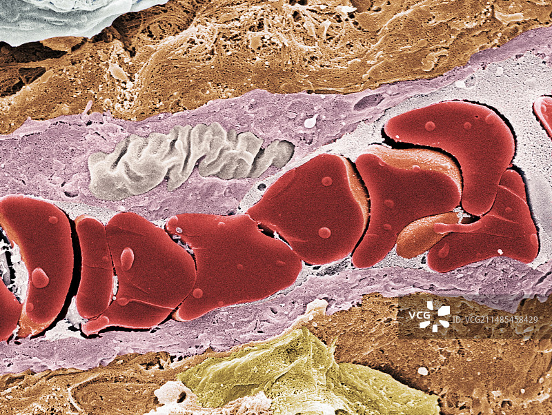 肿瘤血管，扫描电子显微镜图片素材
