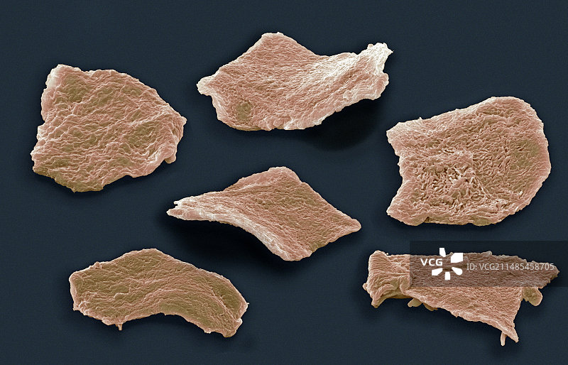 颊鳞状细胞扫描电镜图图片素材