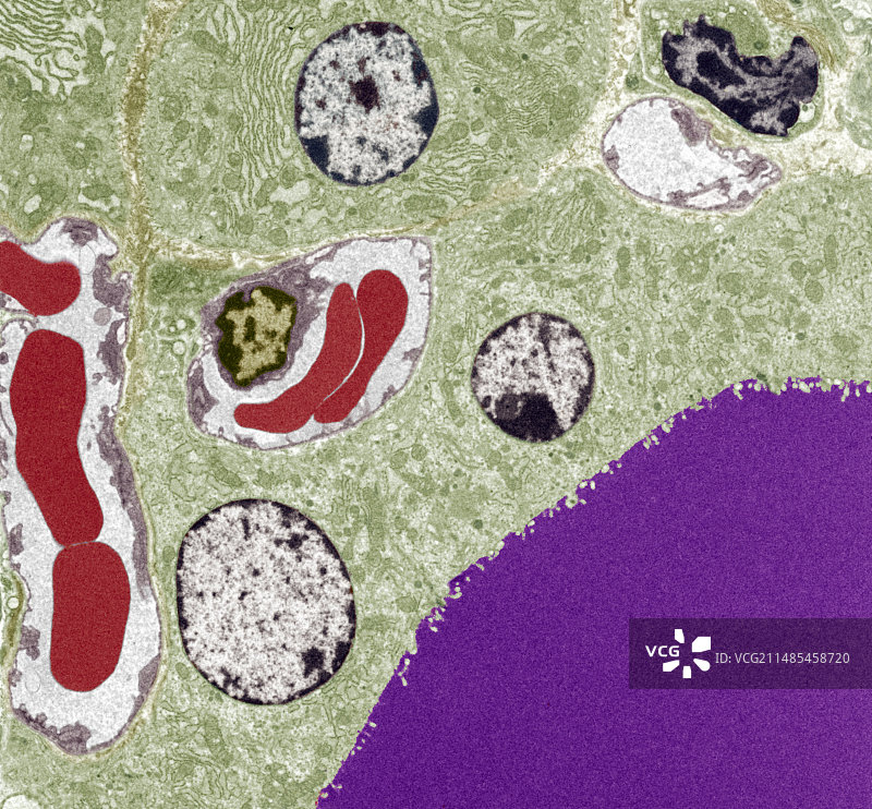 甲状腺滤泡结构，TEM图片素材