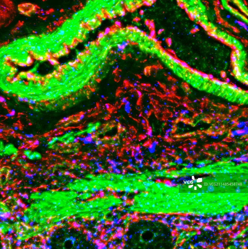 肠道供血图片素材
