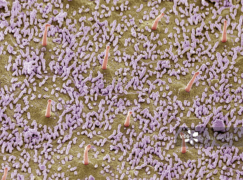 感觉上皮细胞扫描电镜图图片素材