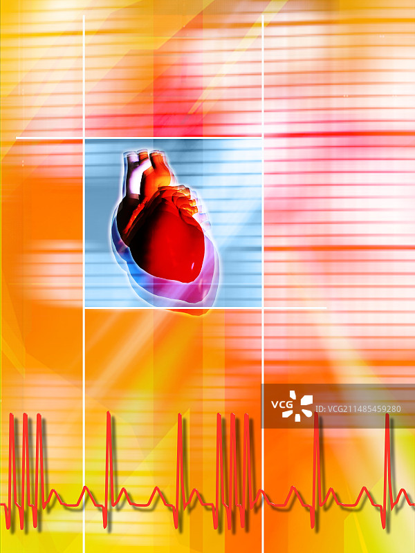 心律不齐图片素材