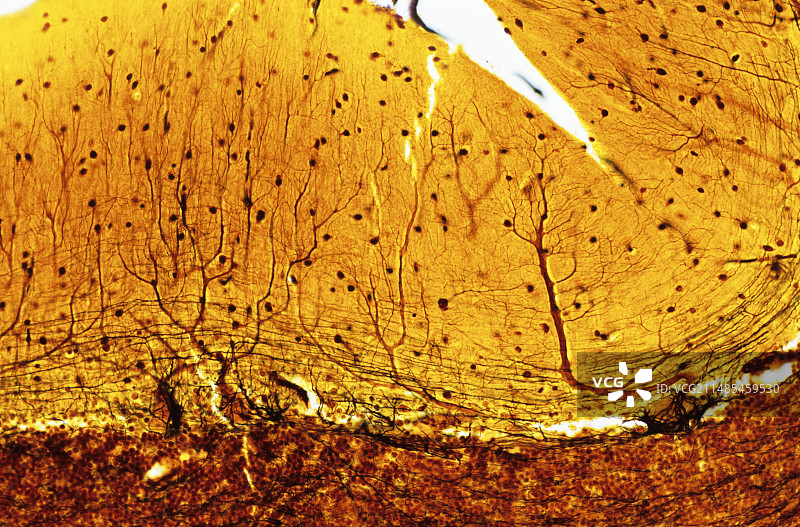 浦肯野神经细胞图片素材