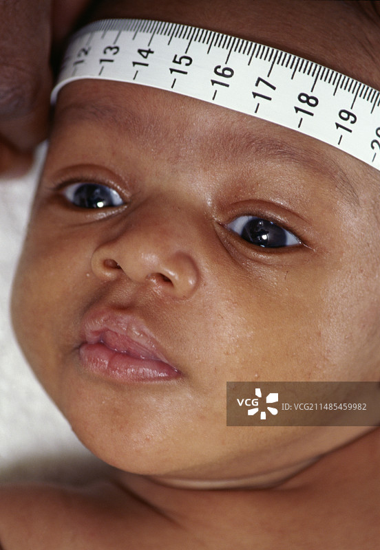 儿科检查图片素材