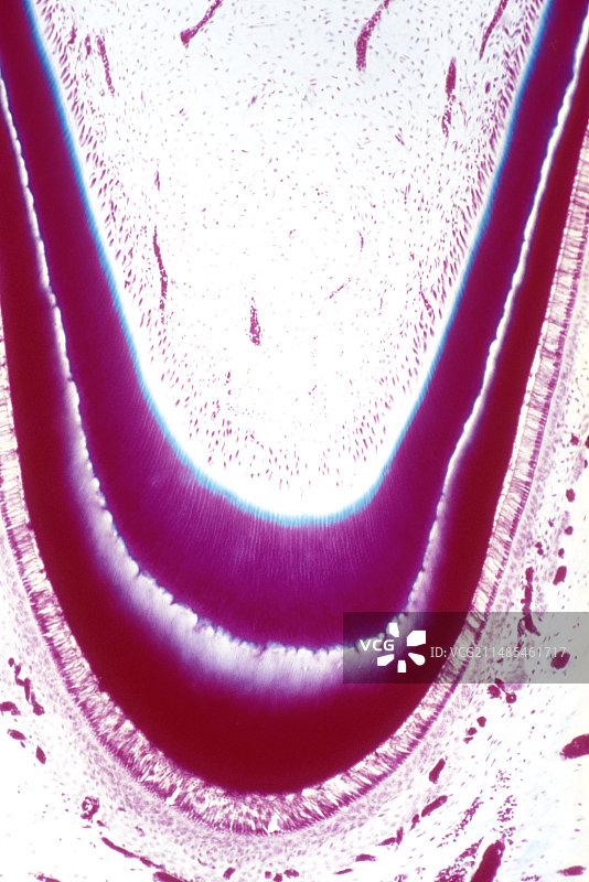 未萌出的胎儿牙齿，光学显微照片图片素材