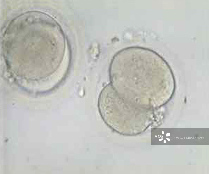 2细胞胚胎显微照片图片素材