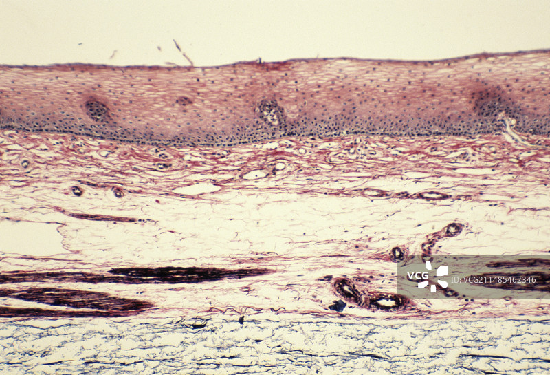 食道壁显微照片图片素材