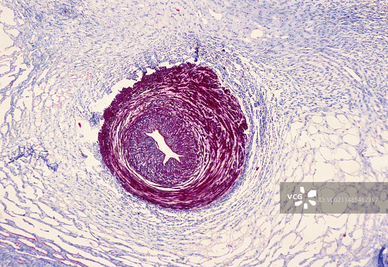 脐带显微照片图片素材