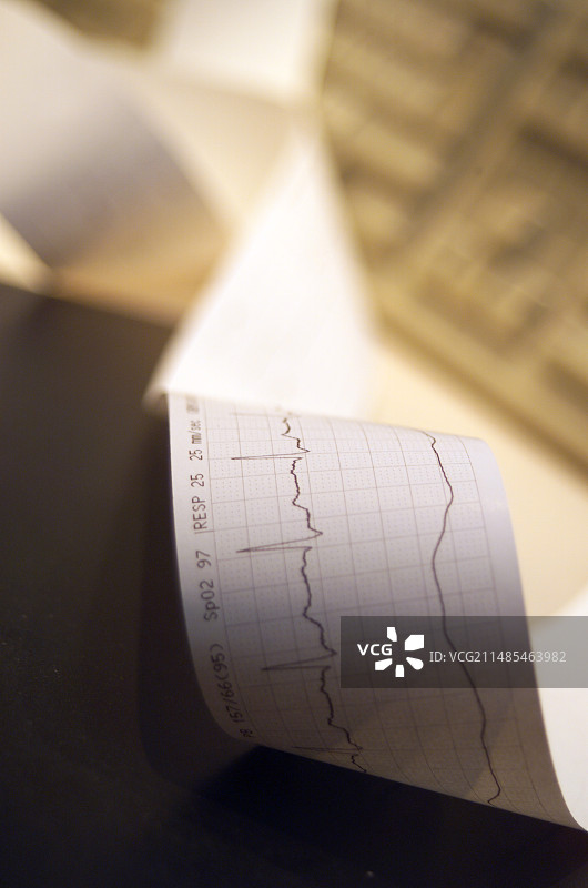 心电图读数图片素材