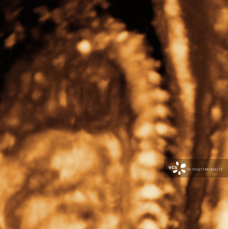 胎儿心脏超声波扫描图片素材