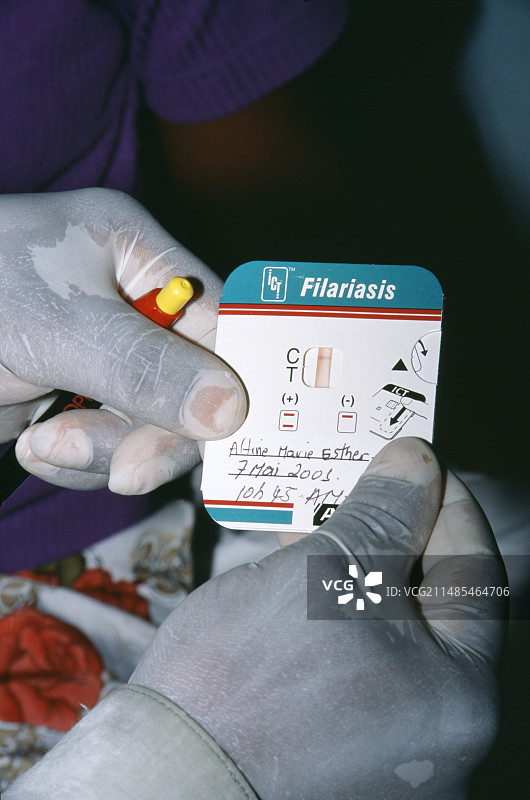 淋巴丝虫病测试图片素材