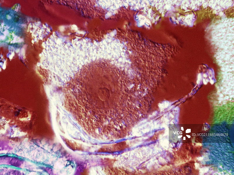 巨噬细胞白细胞图片素材
