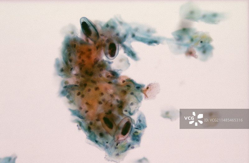 蛲虫卵图片素材