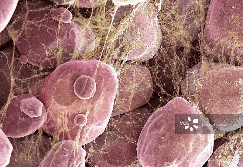 脂肪组织扫描电镜图片素材