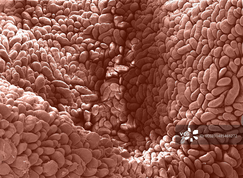 回肠扫描电镜图图片素材