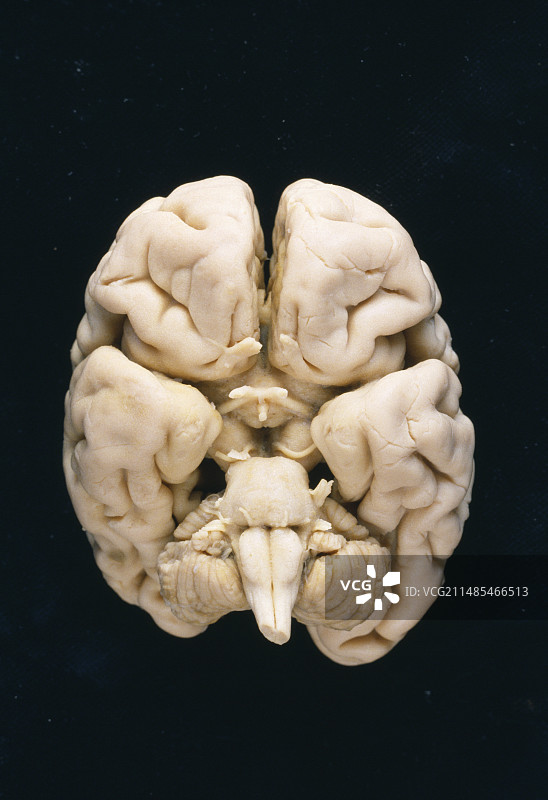 儿童大脑图片素材